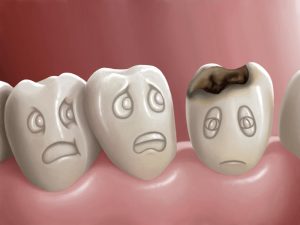 tooth-decay-treatment-types-and-how-to-prevent-it